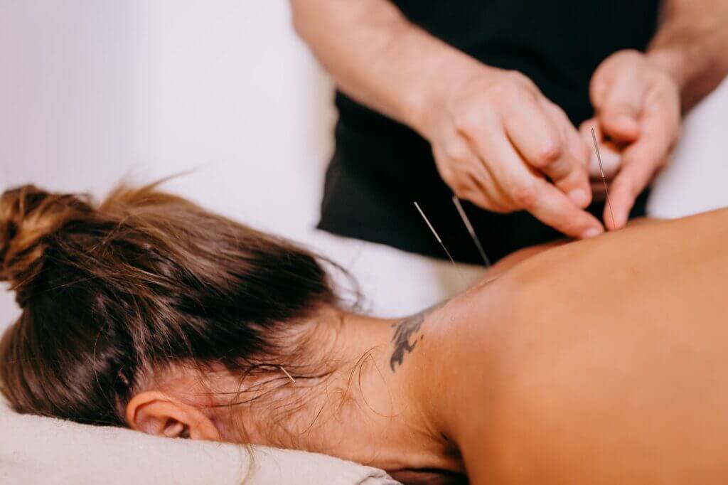 Miami Chiropractic Wellness - Acupuncture