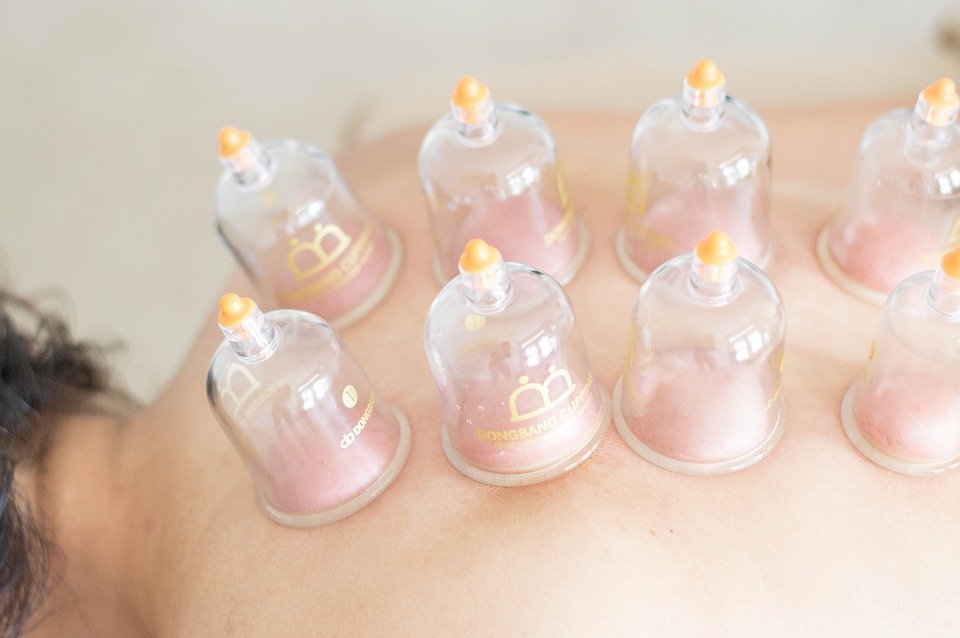 Miami Chiropractic Wellness - Cupping